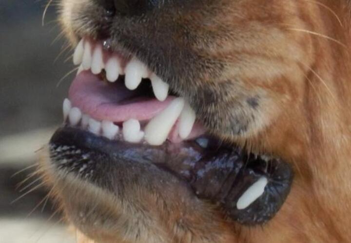 В Краснодаре стая агрессивных собак напала на детей
