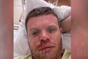 Банда подростков проломила череп мужчине в Краснодаре