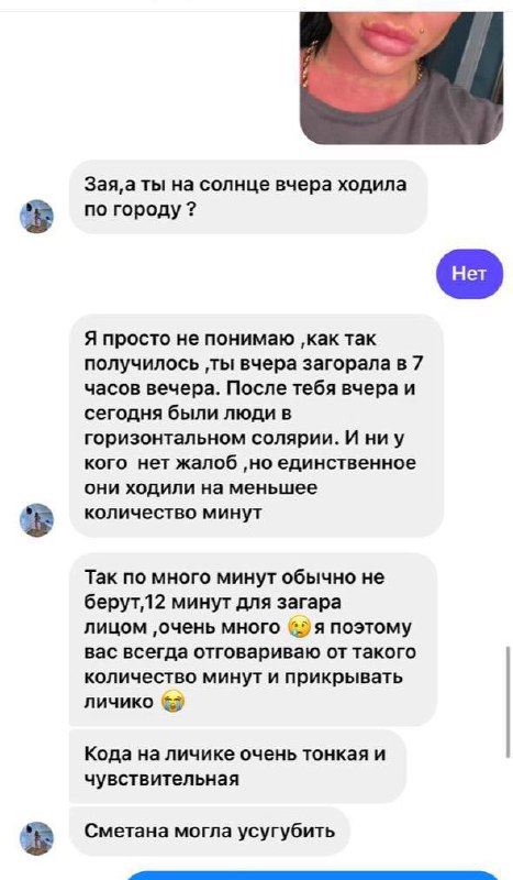 Жительница Краснодара получила страшные ожоги после солярия ВИДЕО