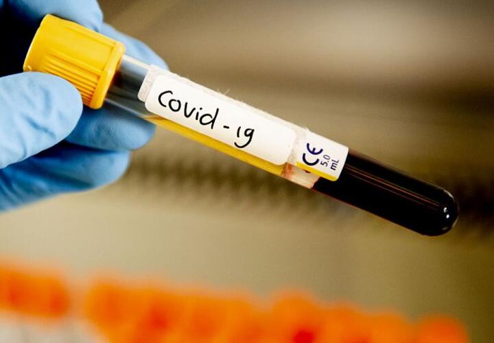 Кубань в антирейтинге регионов по уровню коллективного иммунитета к COVID-19
