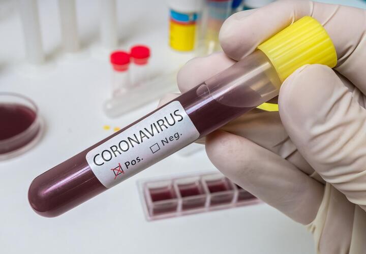 В Краснодарском крае выявлено 156 новых случаев коронавируса