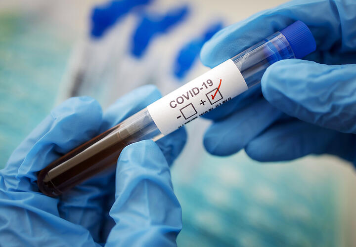 Ученые заявили, что мутации коронавируса вызывает его лечение