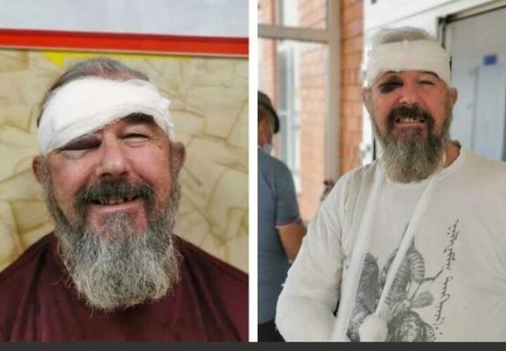 На Кубани полицейские дважды сломали руку 60-летнему мужчине, который не хотел надевать маску? ВИДЕО