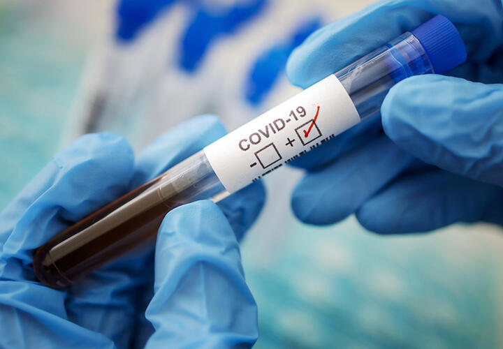 В Краснодарском крае зафиксировали 814 новых случаев коронавируса