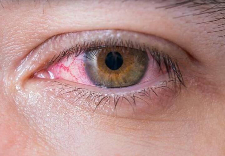 В Майкопе оштрафовали директора школы, где ученики получили ожоги глаз