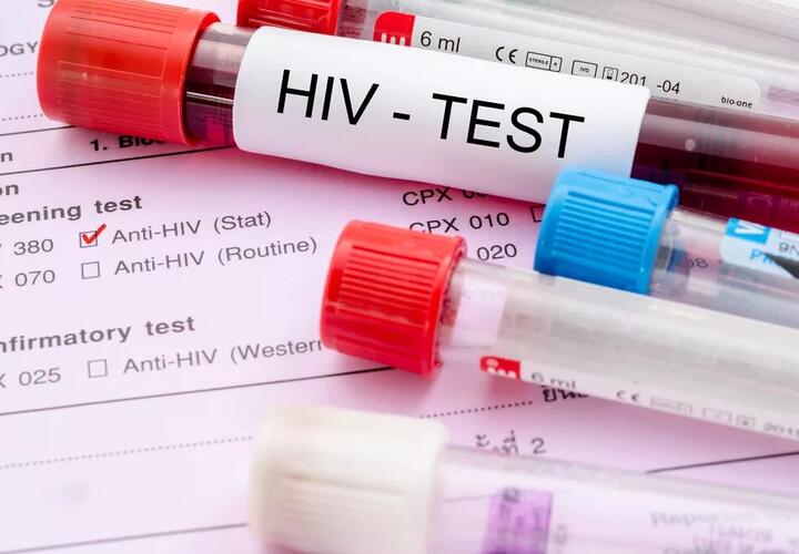 На Кипре выявлен новый штамм ВИЧ, вызывающий СПИД