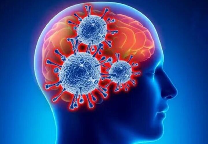 Covid-19 активирует воспаление мозга по типу болезни Паркинсона