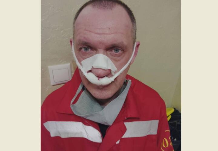 В Краснодаре пациент сломал нос врачу скорой помощи