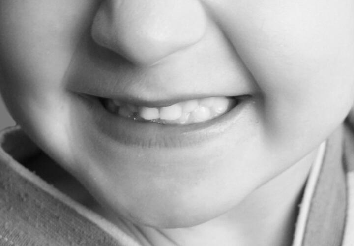 В Ростове-на-Дону медики провели операцию мальчику, у которого не росли зубы