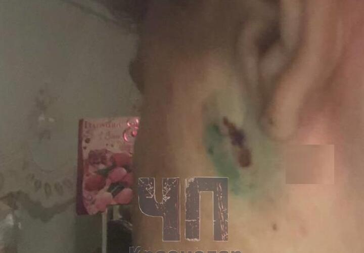 На Кубани 13-летний школьник воткнул нож в лицо старшекласснику