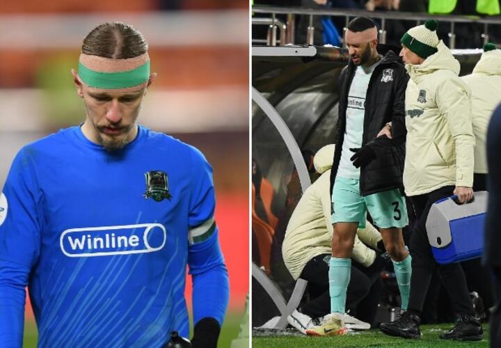 Чья голова крепче: стал известен диагноз травмированных игроков «Краснодара» Тормены и Сафонова