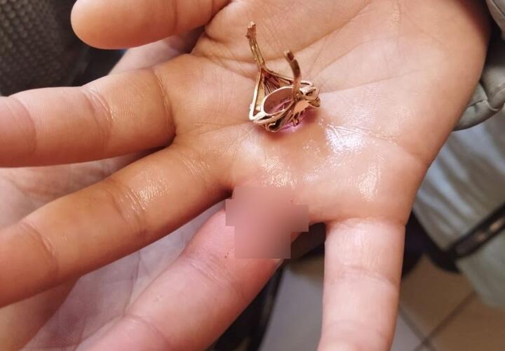 Кольцо с пальца жительницы Новороссийска пришлось снимать спасателям