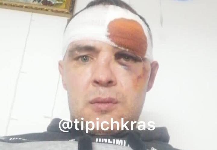 Историю с избиением участника СВО на Кубани полицейские назвали вымыслом