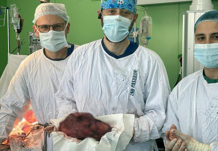 Почку с раковой опухолью весом 4 кг удалили медики в Краснодаре