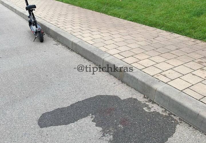 В Краснодаре, в парке Галицкого, разбился 13-летний мальчик