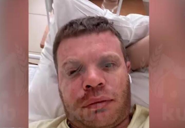 Банда подростков проломила череп мужчине в Краснодаре