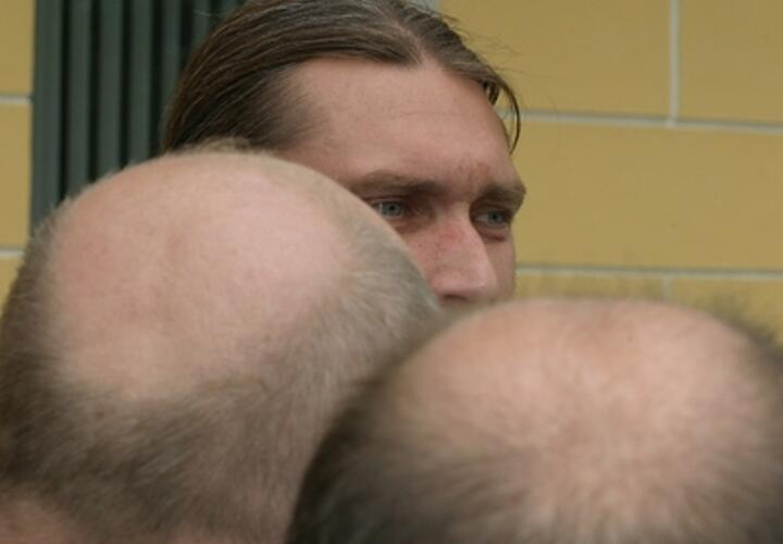 Самый сладкий способ борьбы с облысением обнаружили учёные