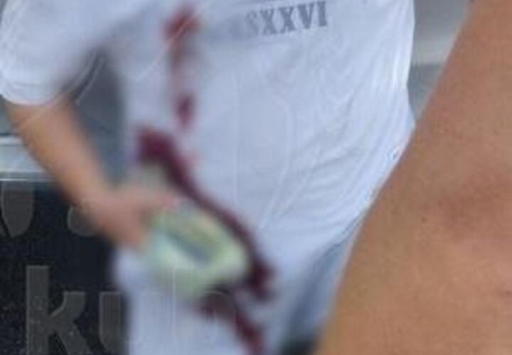 В Новороссийске дорожный конфликт перерос в поножовщину