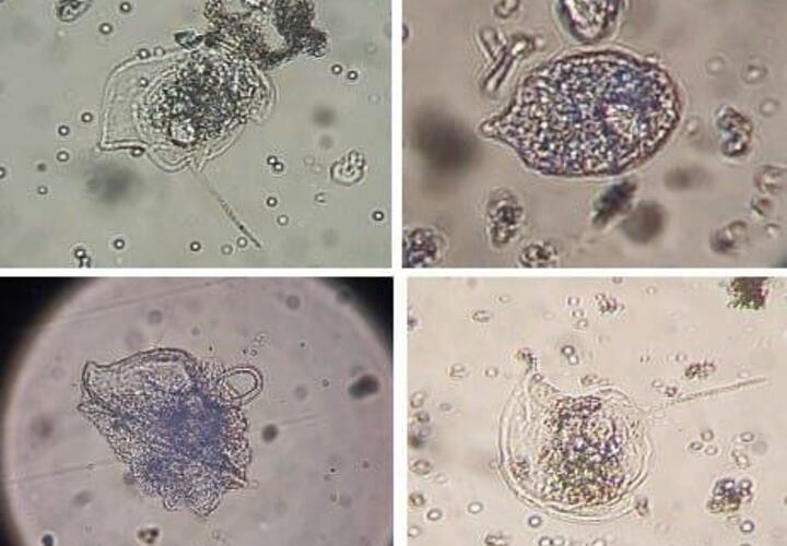 Непрошенные гости: в Чёрном море обнаружили новый вид токсичных водорослей, которые раньше обитали лишь заграницей