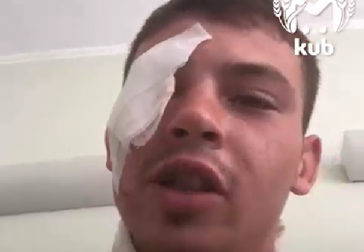 Во время взрыва в ТЦ Апшеронска случайный прохожий частично лишился зрения