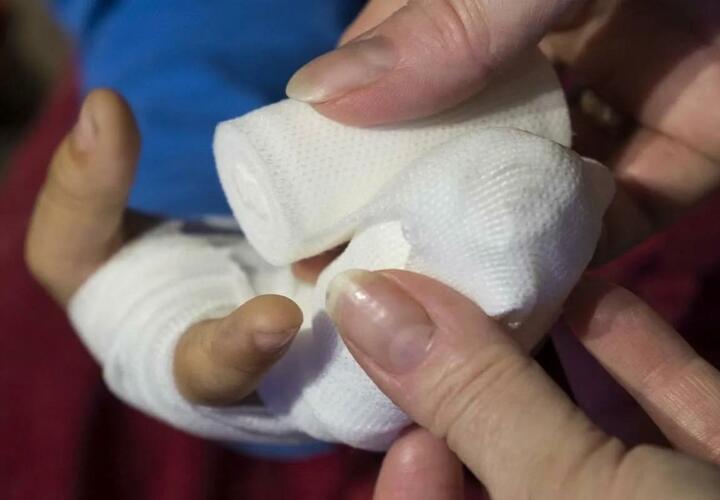 8-летнему мальчику в Сочи взрывом оторвало пальцы