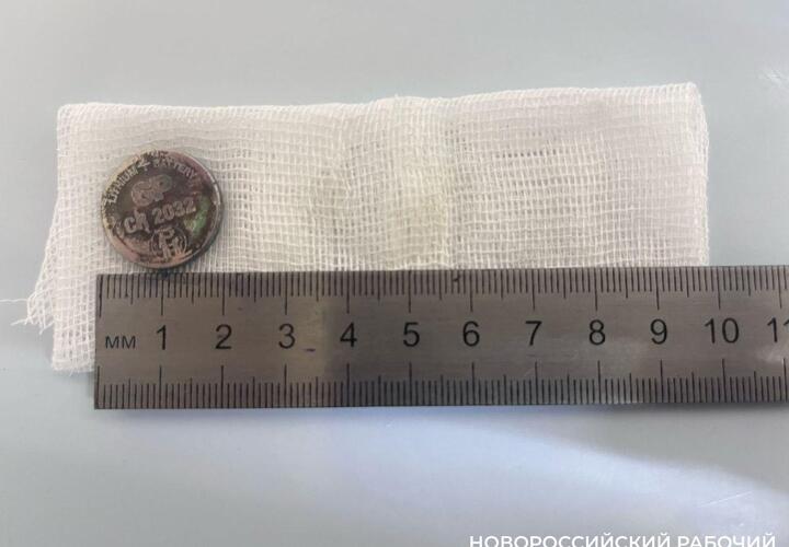 В Новороссийске сачком из желудка 7-летнего ребёнка врачи достали батарейку