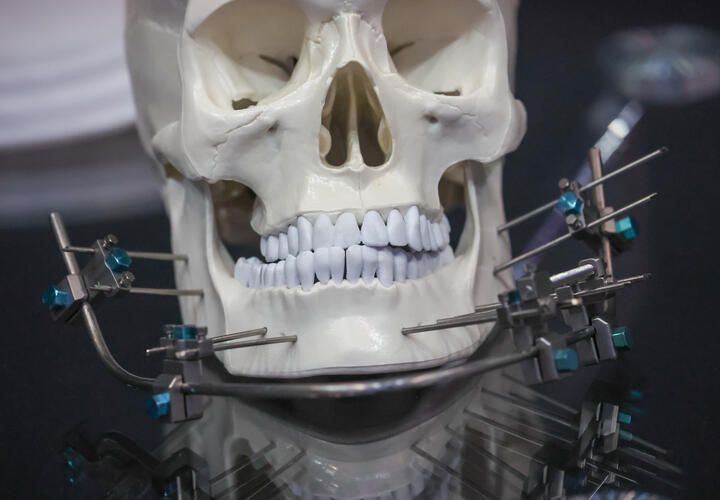 Какие простые продукты неожиданно защитят зубы от кариеса?