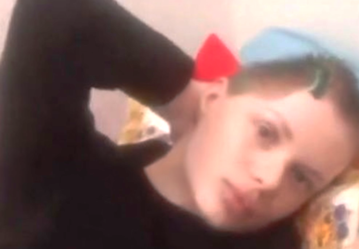 Оставшаяся без половины черепа модель из Краснодара полностью потеряла память