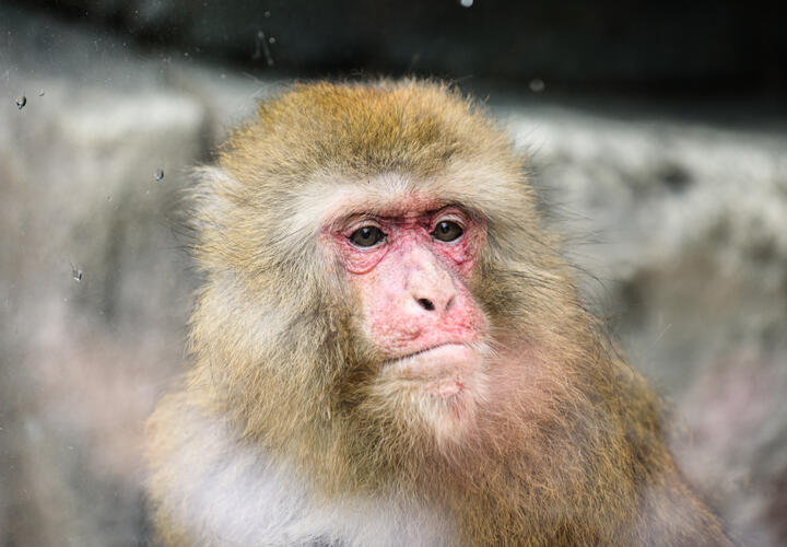 Пациент госпитализирован с высыпаниями и высокой температурой