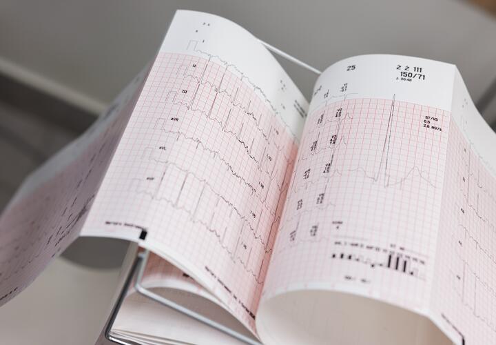 Кардиограмма