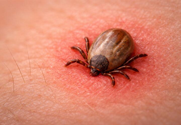 История синдрома альфа‑гал, и почему он может коснуться каждого