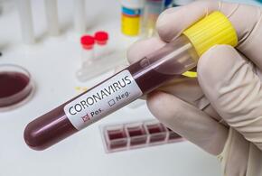 В Краснодарском крае выявлено 156 новых случаев коронавируса