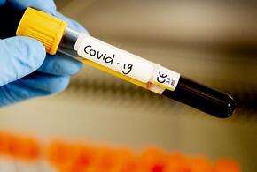 Не уберегли: более 3000 кубанских медиков заразились COVID-19