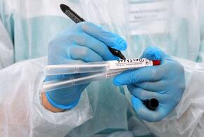 В Краснодарском крае коронавирус подтвердился у 180 человек