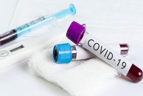 В Краснодарском крае выявили 188 новых случаев коронавируса