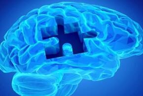Ученые нашли средство для борьбы с болезнью Альцгеймера