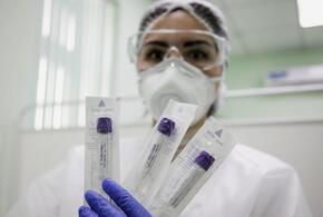 В Краснодарском крае коронавирус зафиксирован в 26 муниципалитетах