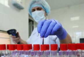 В Краснодарском крае новые случаи коронавируса выявлены в 35 муниципалитетах