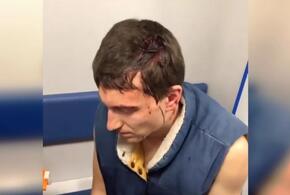 В Сочи во время матча хоккеиста избили клюшкой 