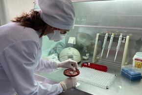 В Краснодарском крае за сутки заболели коронавирусом 151 человек, скончались – 15