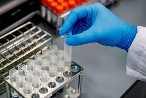 За сутки на Кубани выявлено 67 новых случаев коронавируса
