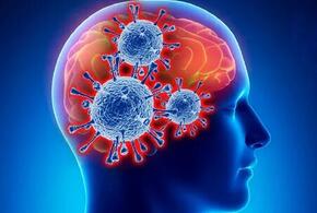 Covid-19 активирует воспаление мозга по типу болезни Паркинсона
