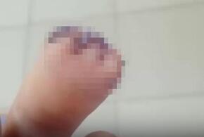 Школьнику на перемене оторвали палец на руке
