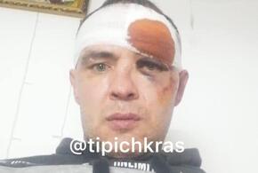 Били или нет: прокуратура и СК проверяют версию полиции  с пострадавшим участником СВО на Кубани