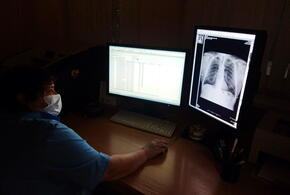 Больной туберкулёзом кубанец отказывался лечиться и заражал других