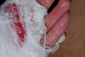 После нападения собаки на женщину с ребёнком в Сочи возбуждено уголовное дело