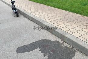 В Краснодаре, в парке Галицкого, разбился 13-летний мальчик