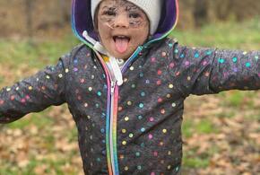 Из-за «ошибок лечения» девочку с «маской Бэтмэна» больше не привезут в Краснодар