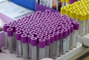 Представители этой группы крови чаще становятся богачами, рассказали учёные