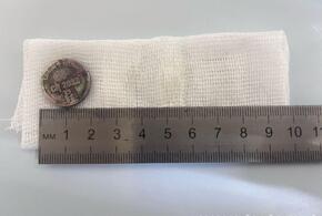 В Новороссийске сачком из желудка 7-летнего ребёнка врачи достали батарейку